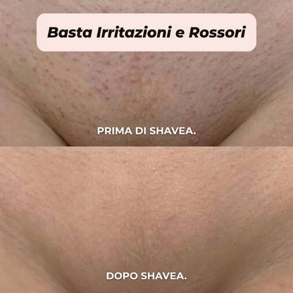 Rasoio 2 in 1 per bikini e corpo Shavea™